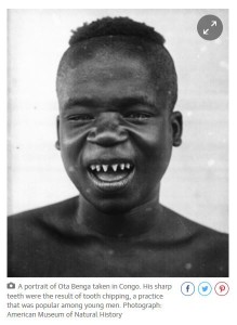 Ota Benga and sharpened teeth